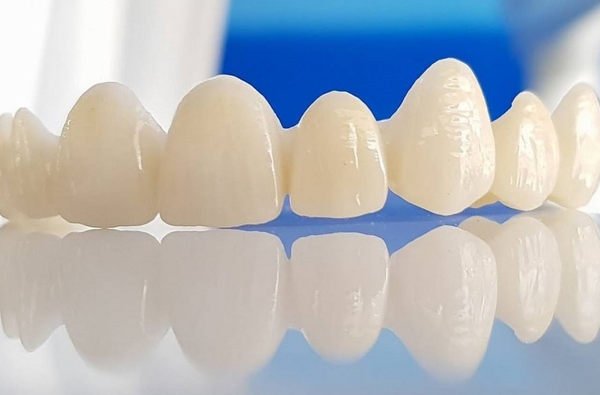 Несъемные протезы зубов из керамики