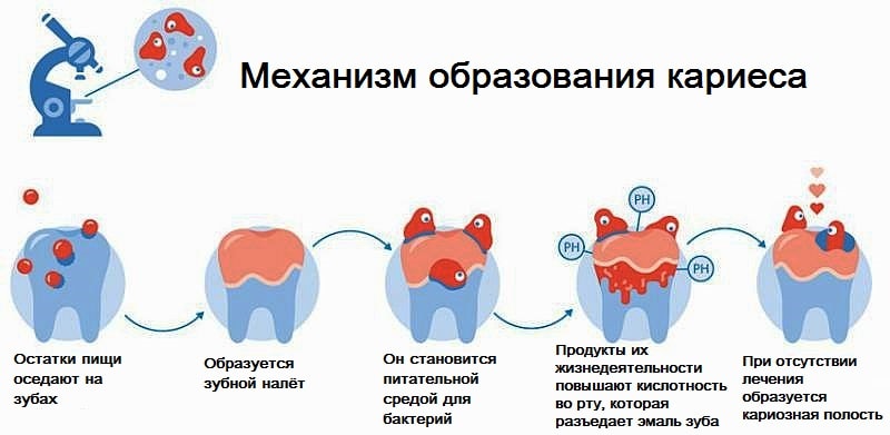 зубной налет образование