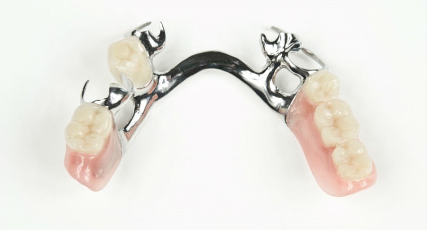 Съемные зубные протезы металл