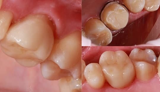 лечение в стоматологии Мытищи
